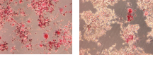 TGF-β1によるRAW264細胞の破骨細胞形成促進　弊社製品 TGF-β1によるRAW264細胞の破骨細胞形成促進　非添加